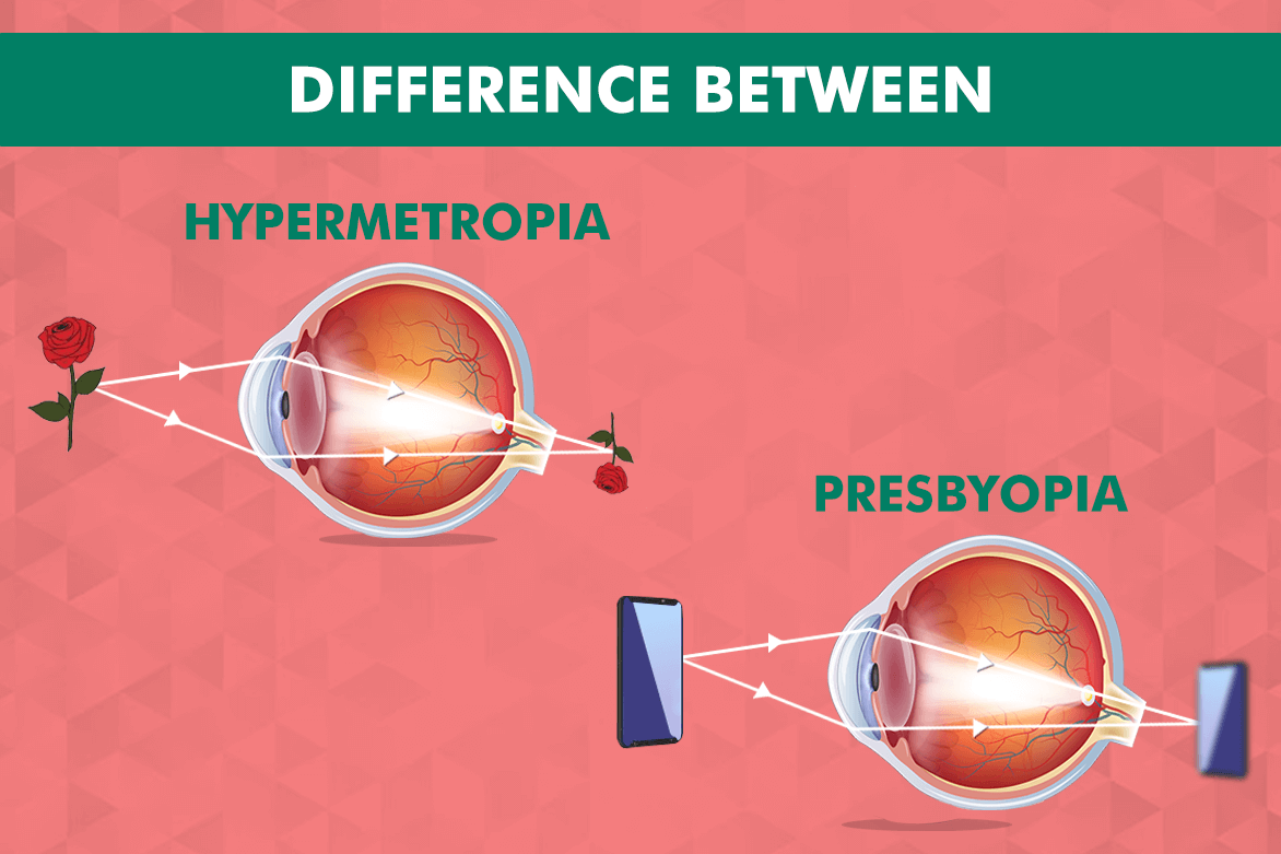 difference between presbyopia and hypermetropia