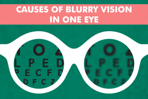 Causes of blurry vision in one eye