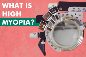 What is high myopia?