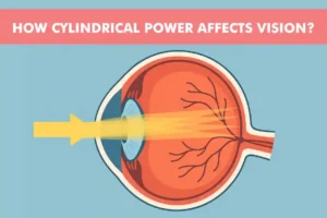 How Cylindrical Power Affects Vision: Causes and Symptoms