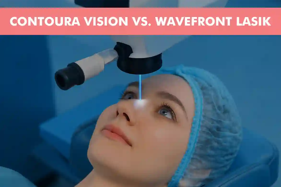 Amazing Wavefront Lasik Eye Surgery Scene Concept Amazing Wavefront Lasik Eye Surgery Scene Concept